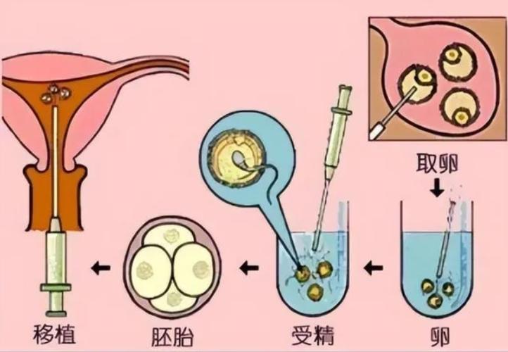 供卵试管代孕正规机构