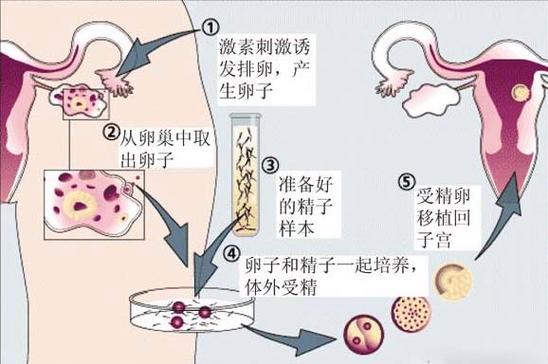供卵试管代孕哪家好